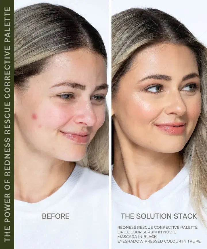 Fitglow Beauty - Redness Rescue Corrective Palette - The Bare Theory