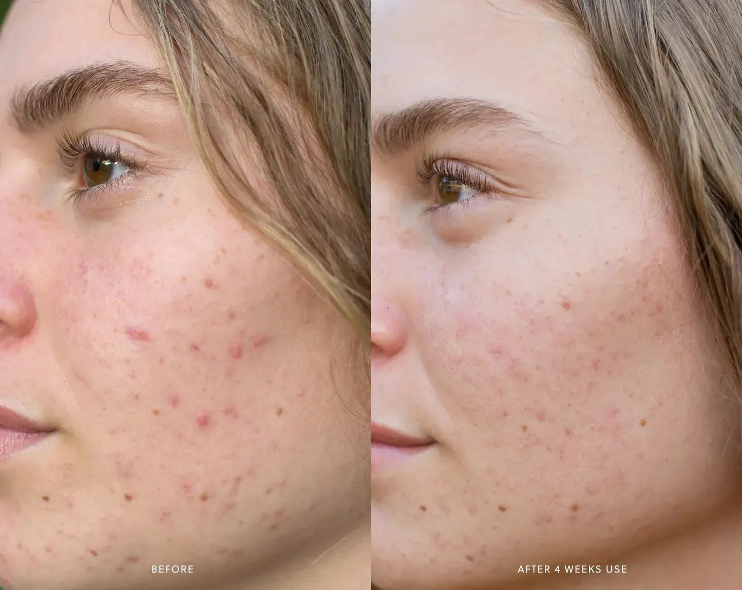 Saya - AHA Micro Exfoliant - The Bare Theory