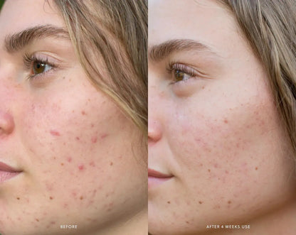 Saya - AHA Micro Exfoliant - The Bare Theory